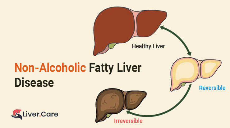 Know your liver